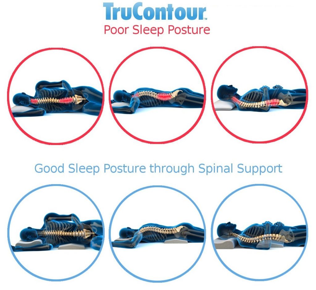 TruContour Support For Back